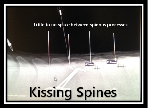 Kissing_Spines_Anotated_2